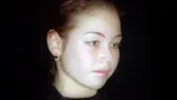 «Набивает себе цену». Ляйсан Утяшева получила жуткую травму, но ей никто не поверил 