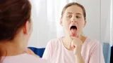 Оказывается, налет на языке может говорить о больших проблемах со здоровьем: проверьтесь, если он белый или желтый