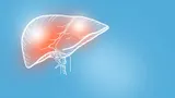 Можно ли проводить детоксикацию печени, чтобы не навредить здоровью